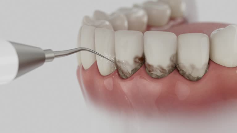 Reliable Emergency Dentist contractor in Cuba, MO by Smile Center Dentistry
